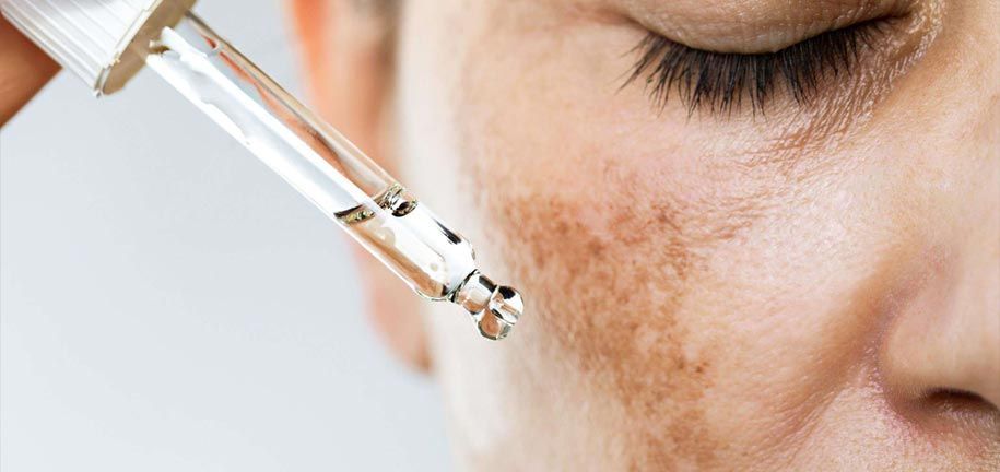 Как Избавиться от Пигментных Пятен