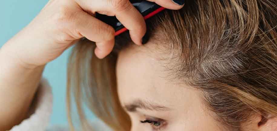 как избавиться от перхоти