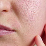 Забитые поры