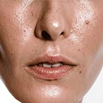 Уход за жирной кожей